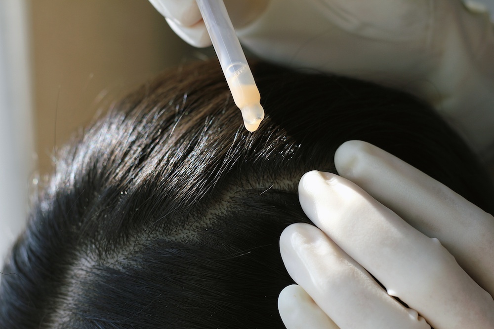 tips on how to treat chemical burns on scalp