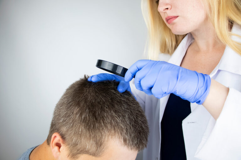 how to treat chemical burns on scalp